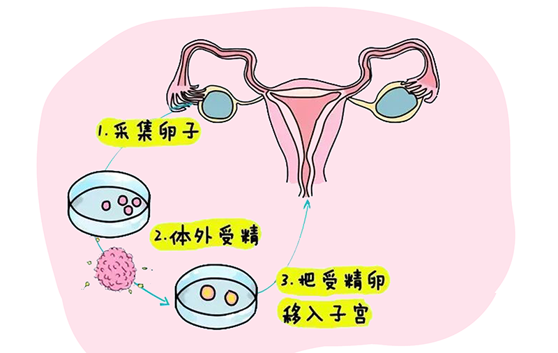 助孕代怀机构,泰国试管婴儿费用详解,试管婴儿成功率高的推荐